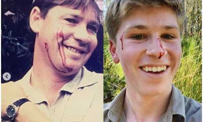 Robert Irwin - kousnutí hadem, krajta diamantová