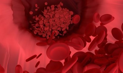 céva, žíly, cévy